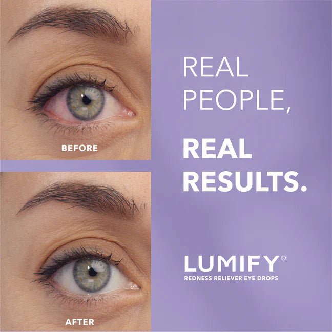 Lumify Redness Reliever Eye Drops