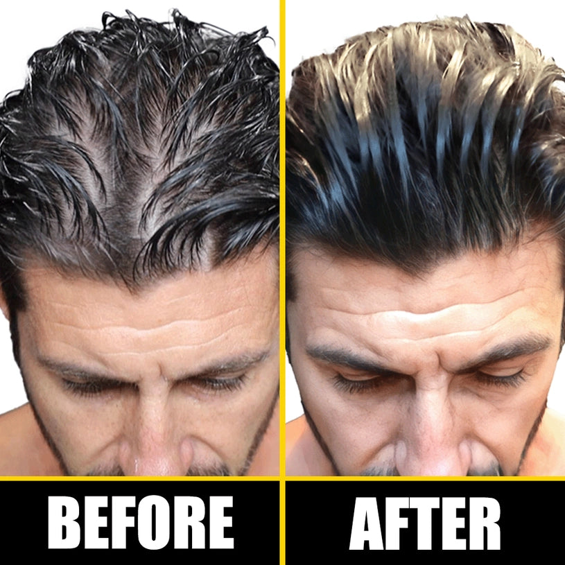 Pete & Pedro BOOST Hair Growth Oil